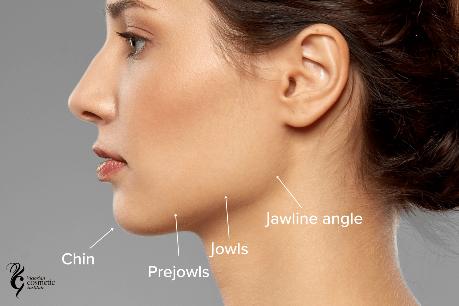 Jawline Filler Melbourne Victorian Cosmetic Institute