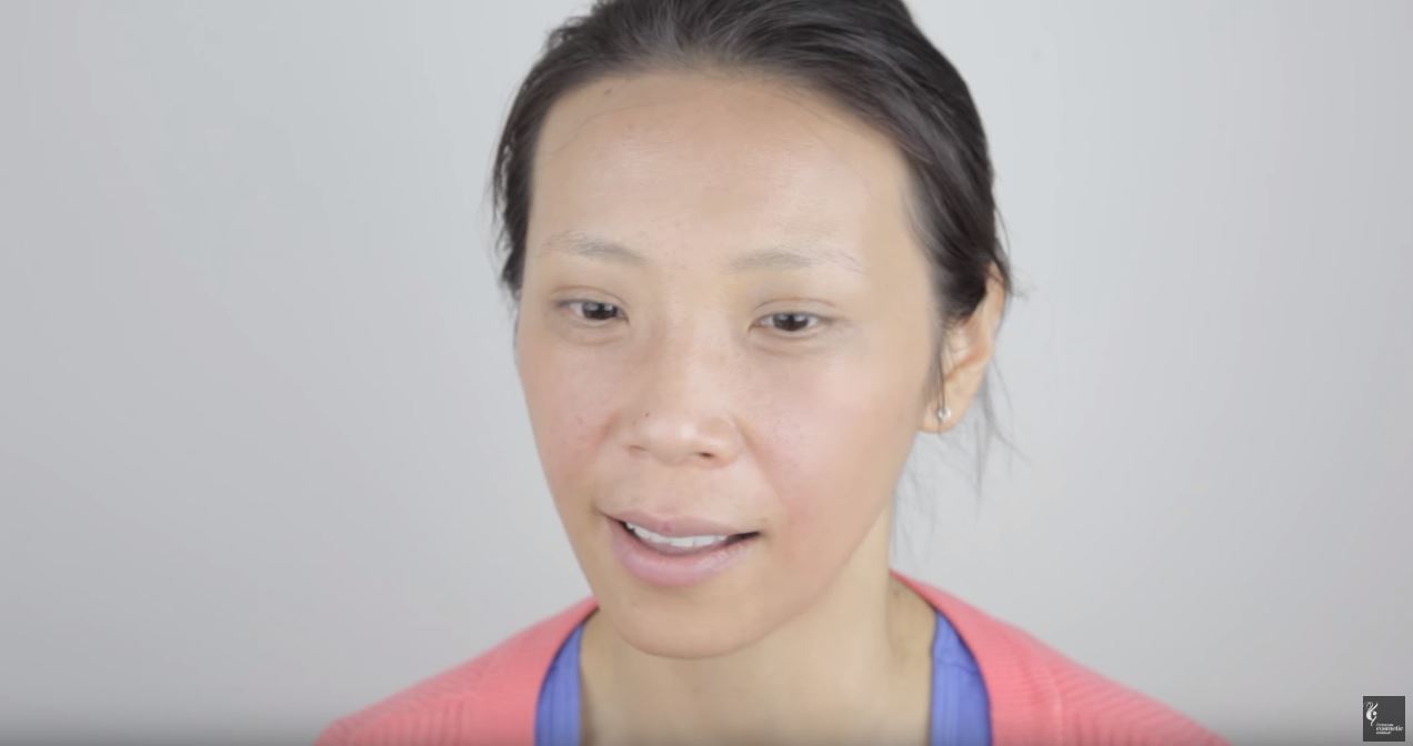 Asian Freckle Laser Treatment Case Study Vci Blog