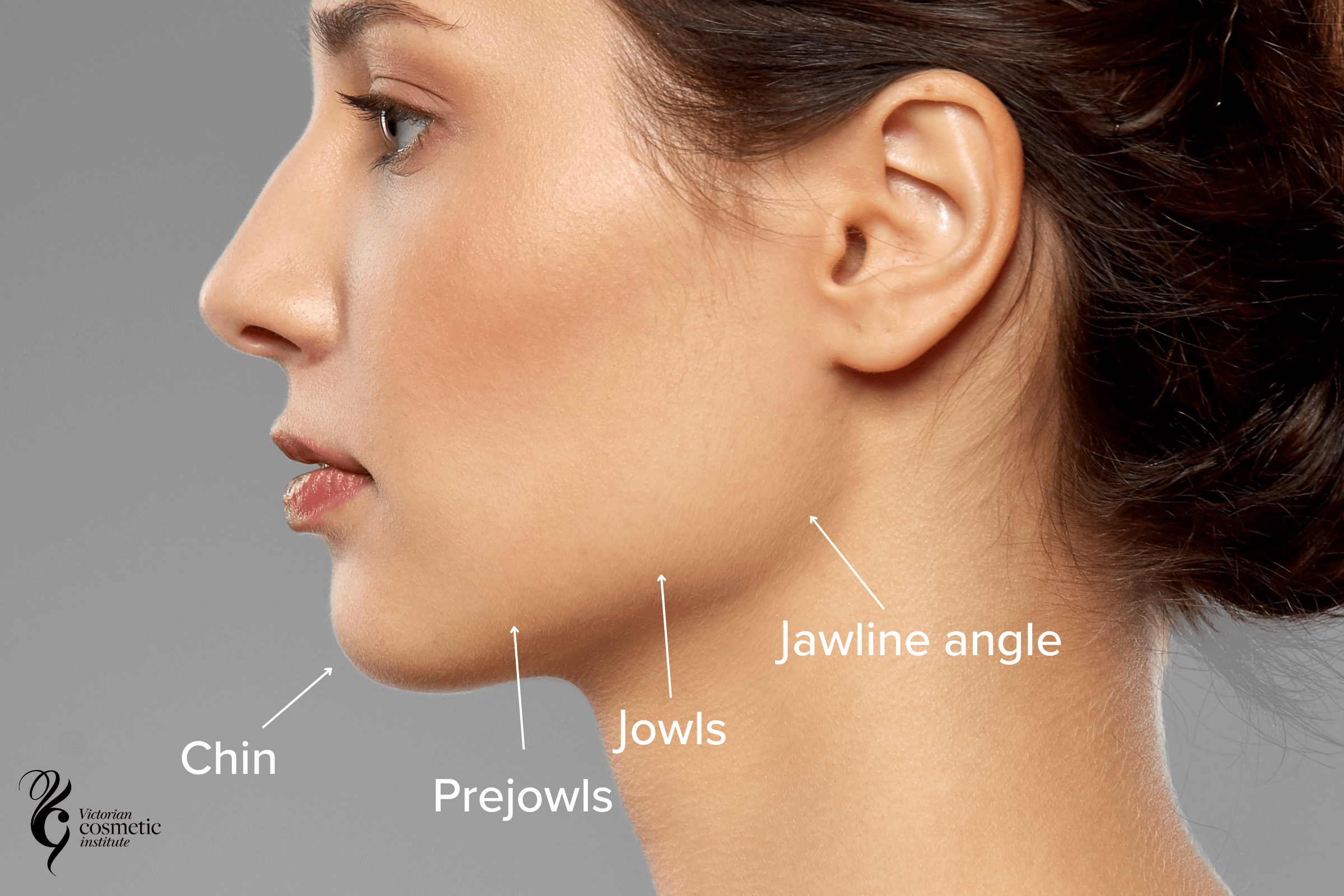 Defined Jawline Before And After